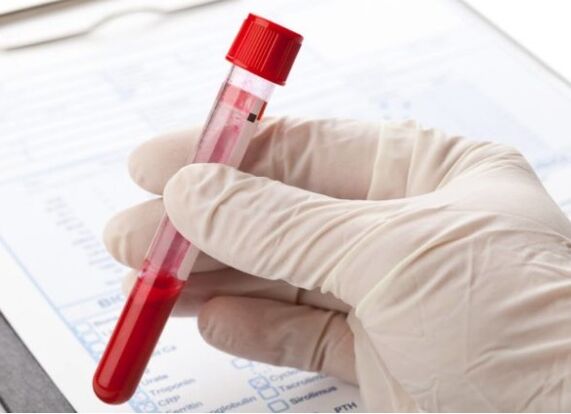 Laboratoriniai diagnostiniai metodai leidžia nustatyti patologinę mikroflorą ar virusą